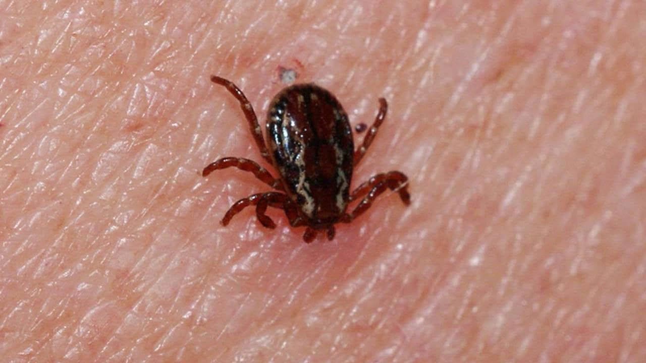 Sivas'ta kene kabusu can aldı: KKKA şüphesiyle hastaneye kaldırılan yurttaş kurtarılamadı!
