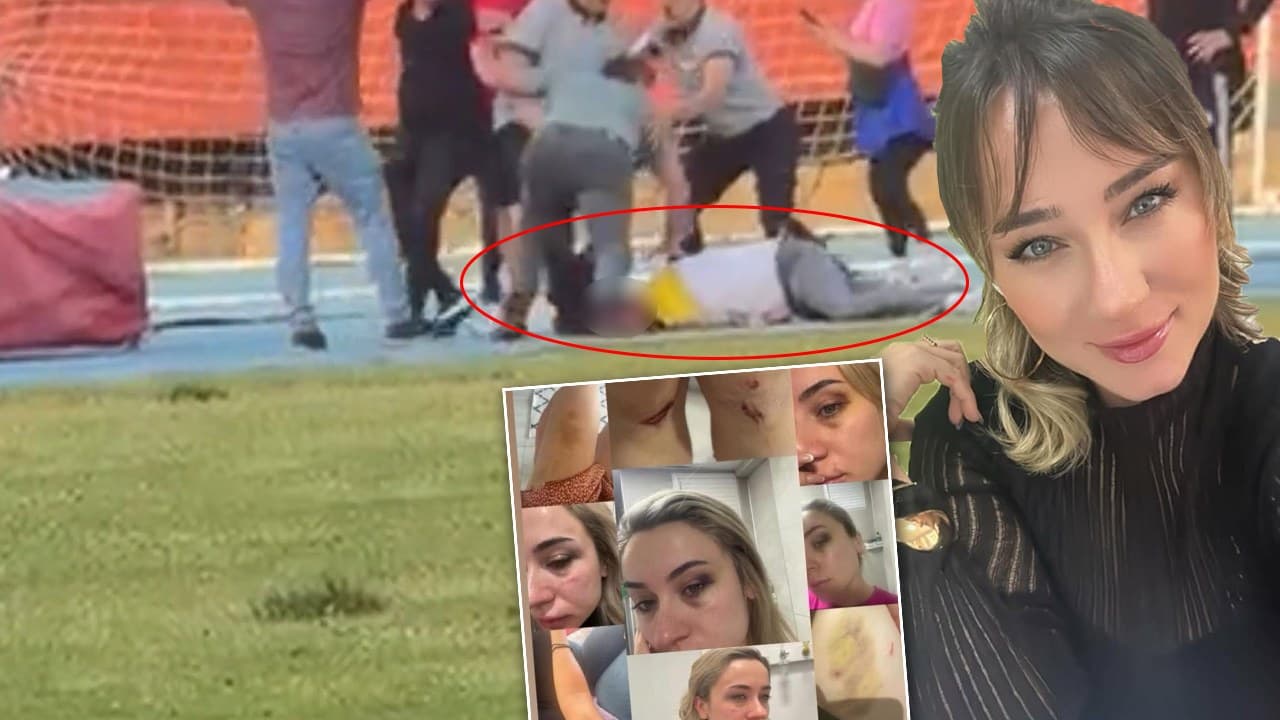 Zonguldak'ta eski eşe tekme-tokat dayak: Elif öğretmenin sosyal medya paylaşımları yürek burkmuştu! Abisi ve arkadaşları…